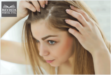 O que fazer para acabar com a calvície feminina O que fazer para acabar com a calvície feminina