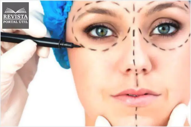 Vale a pena fazer cirurgia plástica, o que ela interfere na sua saúde?