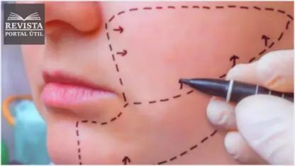 Cirurgia Ortognática: Como funciona e quando é indicado