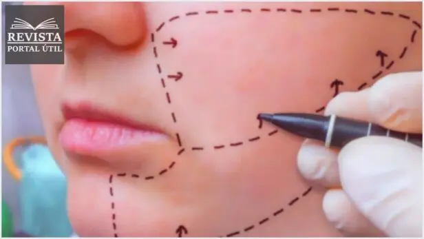 Cirurgia Ortognática: Como funciona e quando é indicado