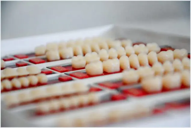 Clareamento dental: o que é importante?