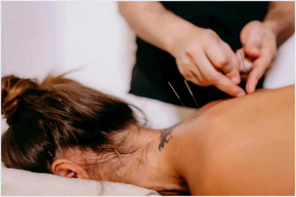 Acupuntura é Bom para Enxaqueca: Alívio e Terapia Acupuntura é Bom para Enxaqueca: Alívio e Terapia